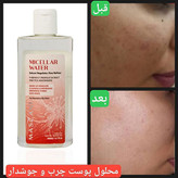 محلول پاک کننده