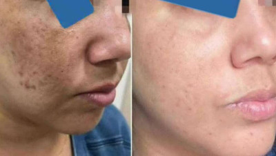کرم روشن کننده ویتامین C ماسکانی