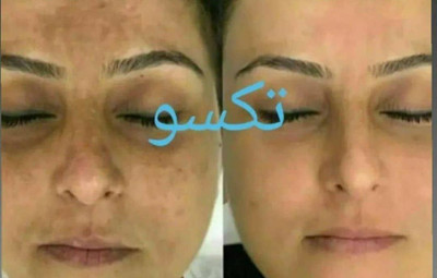 کرم روشن کننده ویتامین C ماسکانی