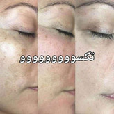 کرم روشن کننده ویتامین C ماسکانی