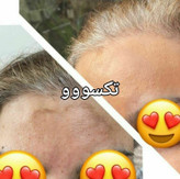 کرم روشن کننده ویتامین C ماسکانی