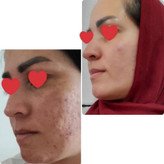 کرم روشن کننده ویتامین C ماسکانی