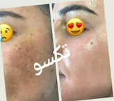 کرم روشن کننده ویتامین C ماسکانی