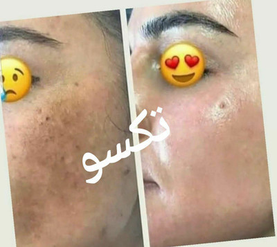 کرم روشن کننده ویتامین C ماسکانی