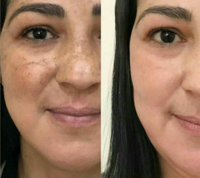 کرم روشن کننده ویتامین C ماسکانی