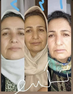 کرم ضدچروک و آبرسان ماسکانی