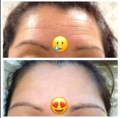 کرم ضدچروک و آبرسان ماسکانی