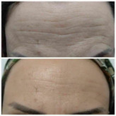 کرم ضدچروک و آبرسان ماسکانی