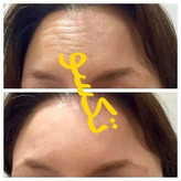 کرم ضدچروک و آبرسان ماسکانی