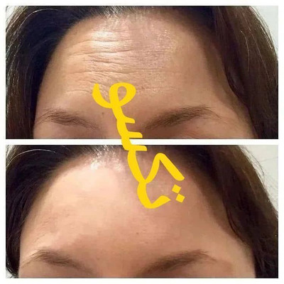کرم ضدچروک و آبرسان ماسکانی