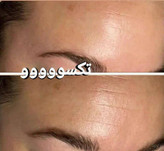 کرم ضدچروک و آبرسان ماسکانی