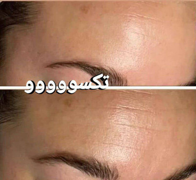 کرم ضدچروک و آبرسان ماسکانی