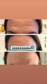 کرم ضدچروک و آبرسان ماسکانی