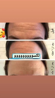 کرم ضدچروک و آبرسان ماسکانی