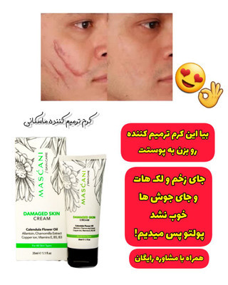 کرم ترمیم کننده پوست ماسکانی