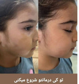 کرم ترمیم کننده پوست ماسکانی