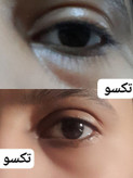 کرم دور چشم سه کاره ماسکانی