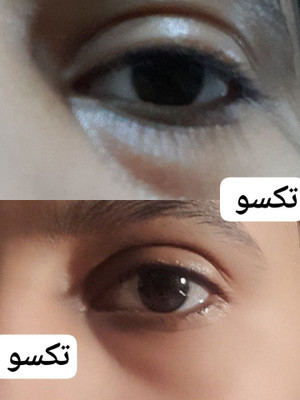کرم دور چشم سه کاره ماسکانی