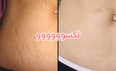 پکیج رفع ترک شکم و زبری دست و پا ماسکانی