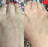 پکیج رفع ترک شکم و زبری دست و پا ماسکانی