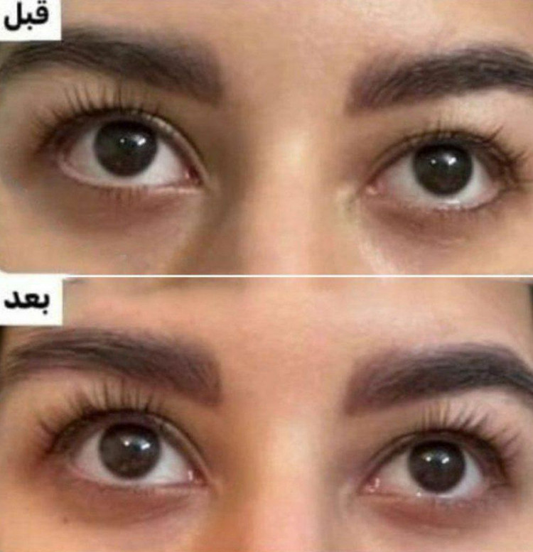 لوسیون تقویت کننده مژه ماسکانی