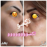 پکیج کامل ضدلک vip ماسکانی