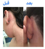 پکیج طلایی اگزما و قرمزی پوست ماسکانی،هازن و تکسو