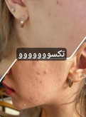 لوسیون ضدجوش و کنترل کننده چربی صورت ماسکانی