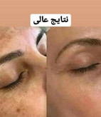 سرم روشنکننده و ضدلک ویتامین C ماسکانی
