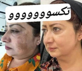 سرم روشنکننده و ضدلک ویتامین C ماسکانی