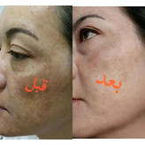 سرم روشنکننده و ضدلک ویتامین C ماسکانی