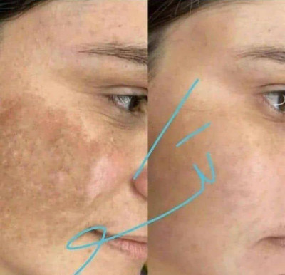 سرم روشنکننده و ضدلک ویتامین C ماسکانی