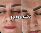 سرم روشنکننده و ضدلک ویتامین C ماسکانی