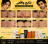 پکیج کامل منافذ باز(پوست چرب) ماسکانی،تکسو
