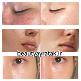 پکیج کامل منافذ باز(پوست مختلط) ماسکانی،تکسو
