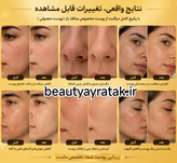 پکیج کامل منافذ باز(پوست معمولی) ماسکانی،تکسو