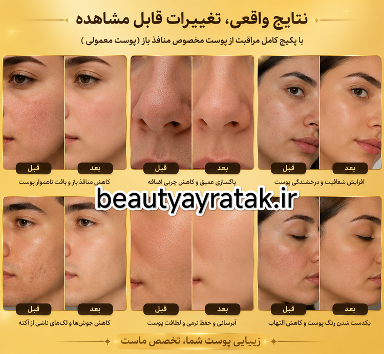 پکیج کامل منافذ باز(پوست معمولی) ماسکانی،تکسو