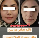 پکیج نقره ای چاقی صورت ماسکانی،تکسو