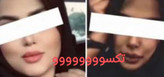 پکیج نقره ای چاقی صورت ماسکانی،تکسو