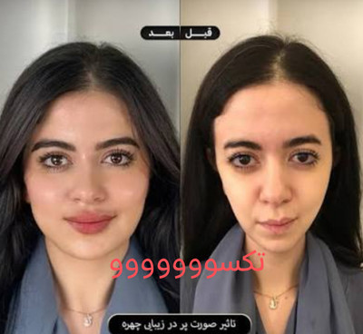 پکیج نقره ای چاقی صورت ماسکانی،تکسو