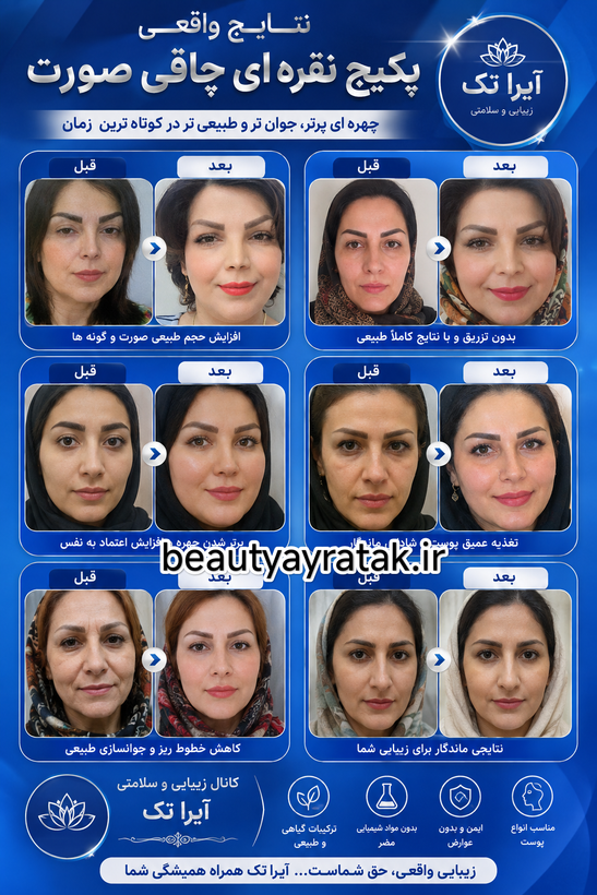 پکیج نقره ای چاقی صورت ماسکانی،تکسو