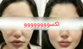 پکیج نقره ای چاقی صورت ماسکانی،تکسو
