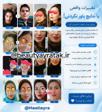 پکیج طلایی چاقی صورت ماسکانی و تکسو