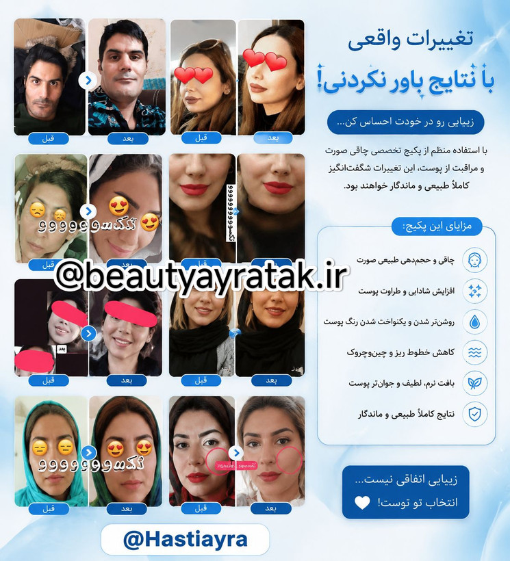 پکیج طلایی چاقی صورت ماسکانی و تکسو