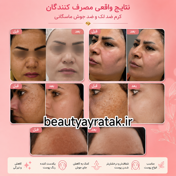 کرم ضدلک و روشن کننده پوست ماسکانی